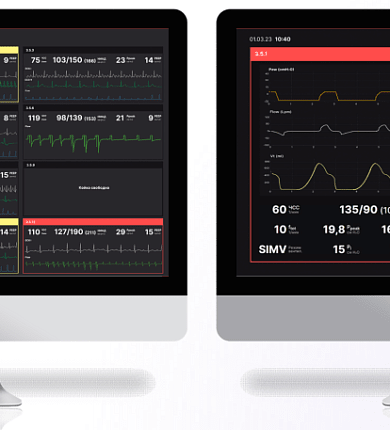 Центральная мониторная станция АО "УПЗ" для отделений интенсивной терапии успешно испытана в клиниках